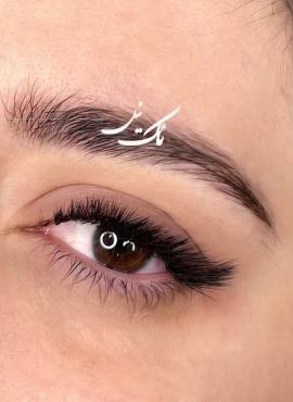 نمونه کار کاشت مژه